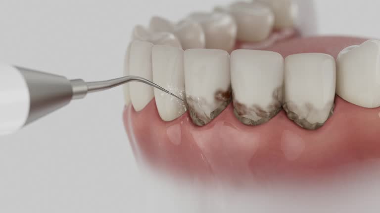 Trusted Tooth Extraction service in Kilauea, HI - Dentist Open Now